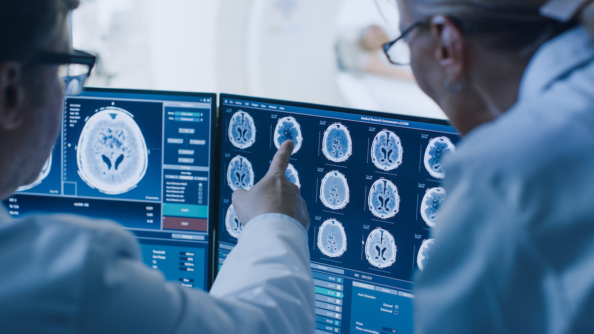 doctors viewing mri